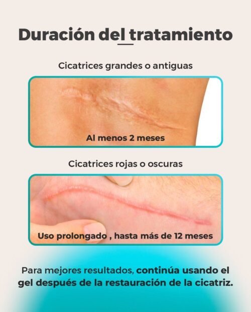 Gel Cicatrizante Rystora