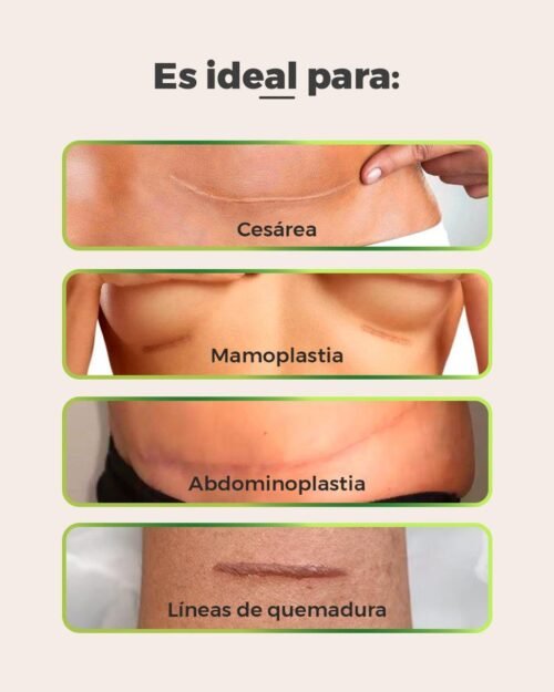 Kit de tratamiento de abdomen