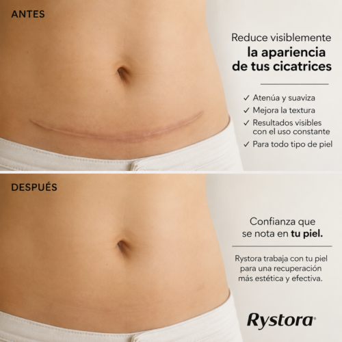 Kit de tratamiento (3 meses)